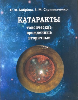 Катаракты - токсические, врожденные, вторичные