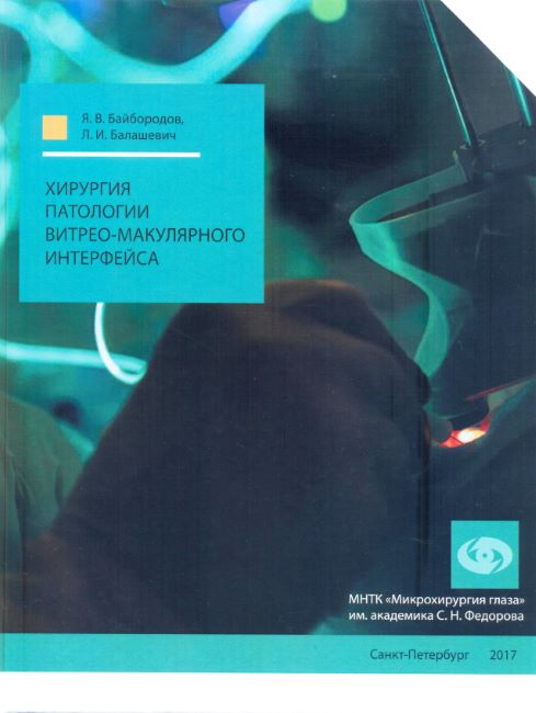 Хирургия патологии витрео-макулярного интерфейса