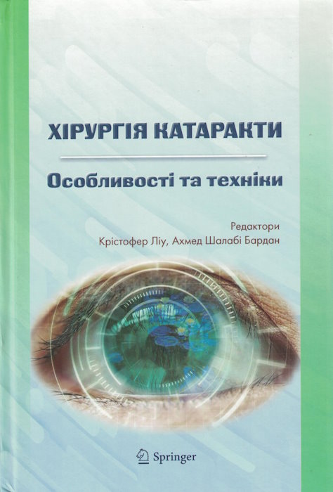 Хірургія катаракти. Особивості та техніки.