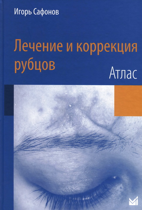 Лечение и коррекция рубцов. Атлас