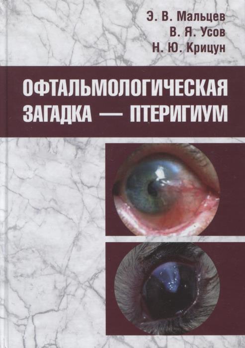 Офтальмологическая загадка — птеригиум