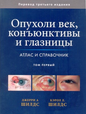 Опухоли век, конъюнктивы и глазницы. Атлас и справочник. Том 1