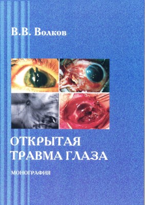 Открытая травма глаза