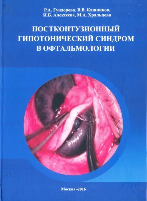 Постконтузионный гипотонический синдром в офтальмологии