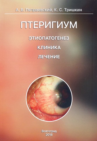 Птеригиум. Этиопатогенез, клиника, лечение
