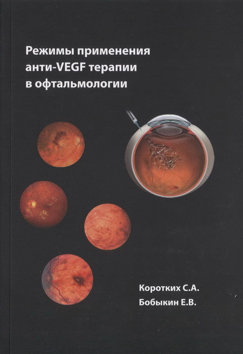 Режимы применения анти-VEGF терапии в офтальмологии