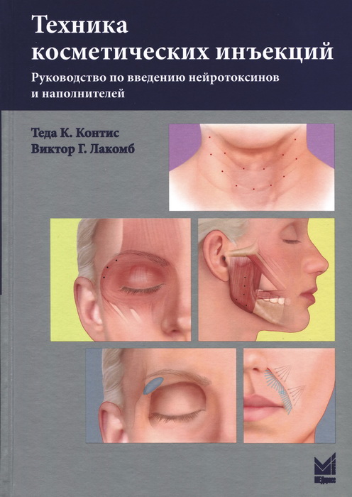 Техника косметических инъекций. Руководство по введению нейротоксинов и наполнителей