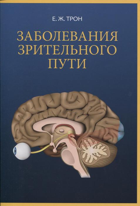 Заболевания зрительного пути