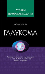 Глаукома