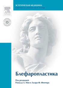 Блефаропластика