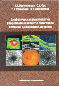 Диабетическая макулопатия. Современные аспекты патогенеза, клиники, диагностики, лечения