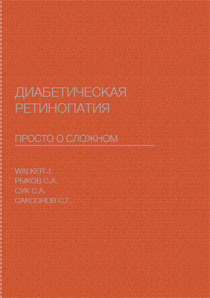 Диабетическая ретинопатия. Просто о сложном