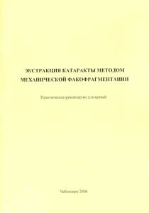 Экстракция катаракты методом механической факофрагментации