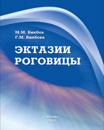 Эктазии роговицы