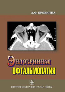Эндокринная офтальмопатия