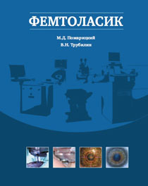 Фемтоласик