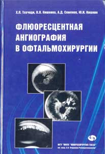 Флюоресцентная агниография в офтальмохирургии