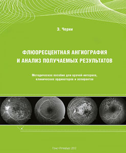 Флюоресцентная ангиография и анализ получаемых результатов