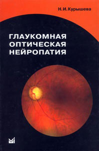Глаукомная оптическая нейропатия