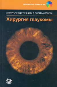Хирургия глаукомы