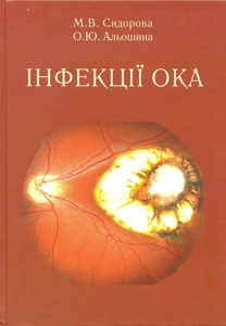 Інфекції ока