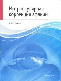 Интраокулярная коррекция афакии
