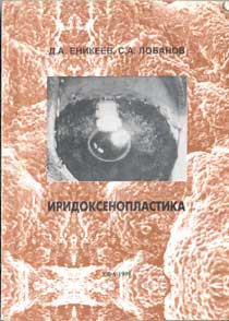 Иридоксенопластика