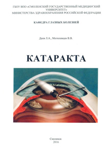 Катаракта
