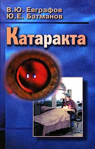 Катаракта