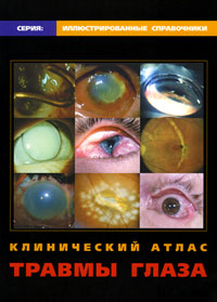 Клинический атлас травмы глаза