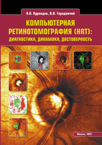 Компьютерная ретинотомография (HRT): диагностика, динамика, достоверность