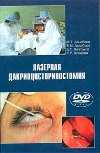 Лазерная дакриоцисториностомия