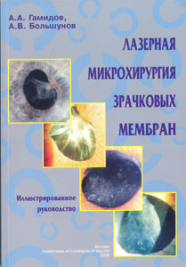 Лазерная микрохирургия зрачковых мембран