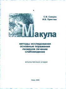 Макула
