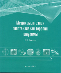 Медикаментозная гипотензивная терапия глаукомы