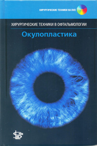Окулопластика