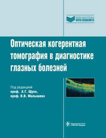 Оптическая когерентная томография в диагностике глазных болезней