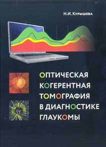Оптическая когерентная томография в диагностике глаукомы
