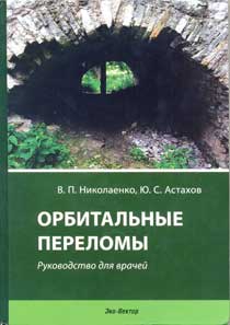 Орбитальные переломы: руководство для врачей