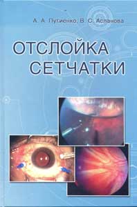 Отслойка сетчатки
