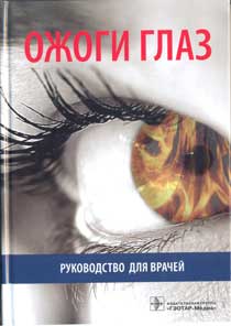Ожоги глаз. Руководство для врачей