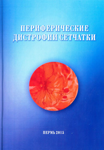 Периферические дистрофии сетчатки