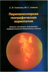 Перипапиллярная географическая хориопатия