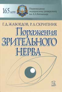 Поражения зрительного нерва