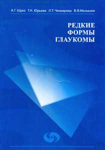Редкие формы глаукомы