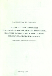 Реконструктивная хирургия сочетанной патологии радужки и хрусталика на основе имплантации искусственной иридохрусталиковой диафрагмы