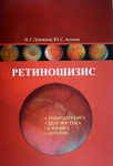 Ретиношизис. Этиопатогенез, диагностика, клиника, лечение