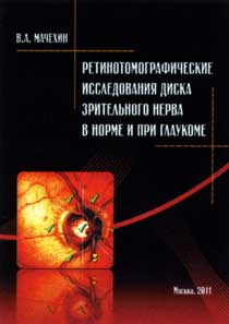 Ретинотомографические исследования диска зрительного нерва в норме и при глаукоме