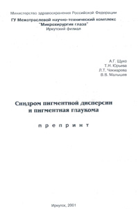 Синдром пигментной дисперсии и пигментная глаукома