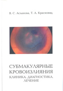 Субмакулярные кровоизлияния. Клиника, диагностика, лечение